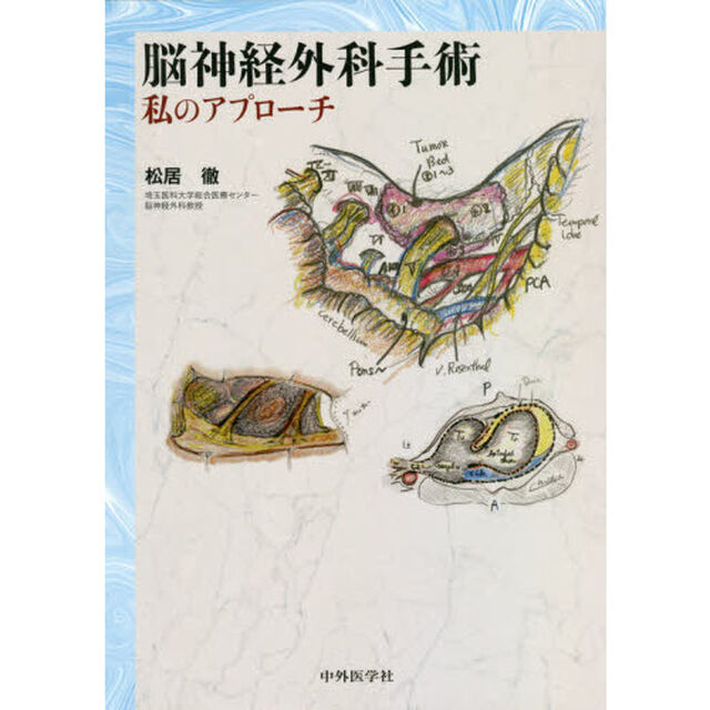 脳神経外科手術私のアプローチ