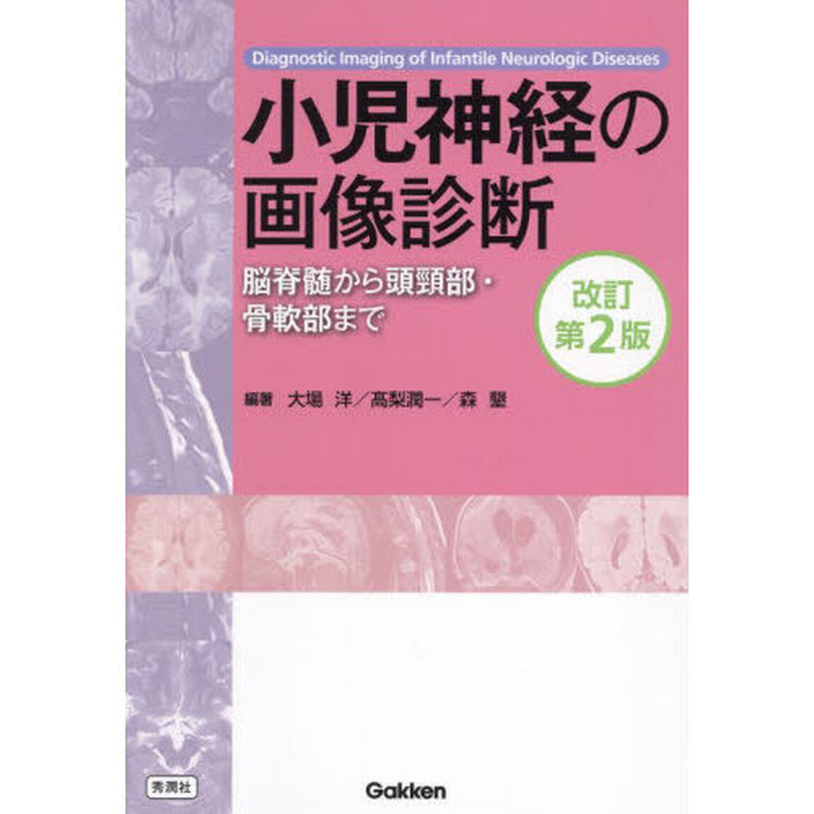 小児神経の画像診断　脳脊髄から頭頸部・骨軟部まで「改訂第２版」