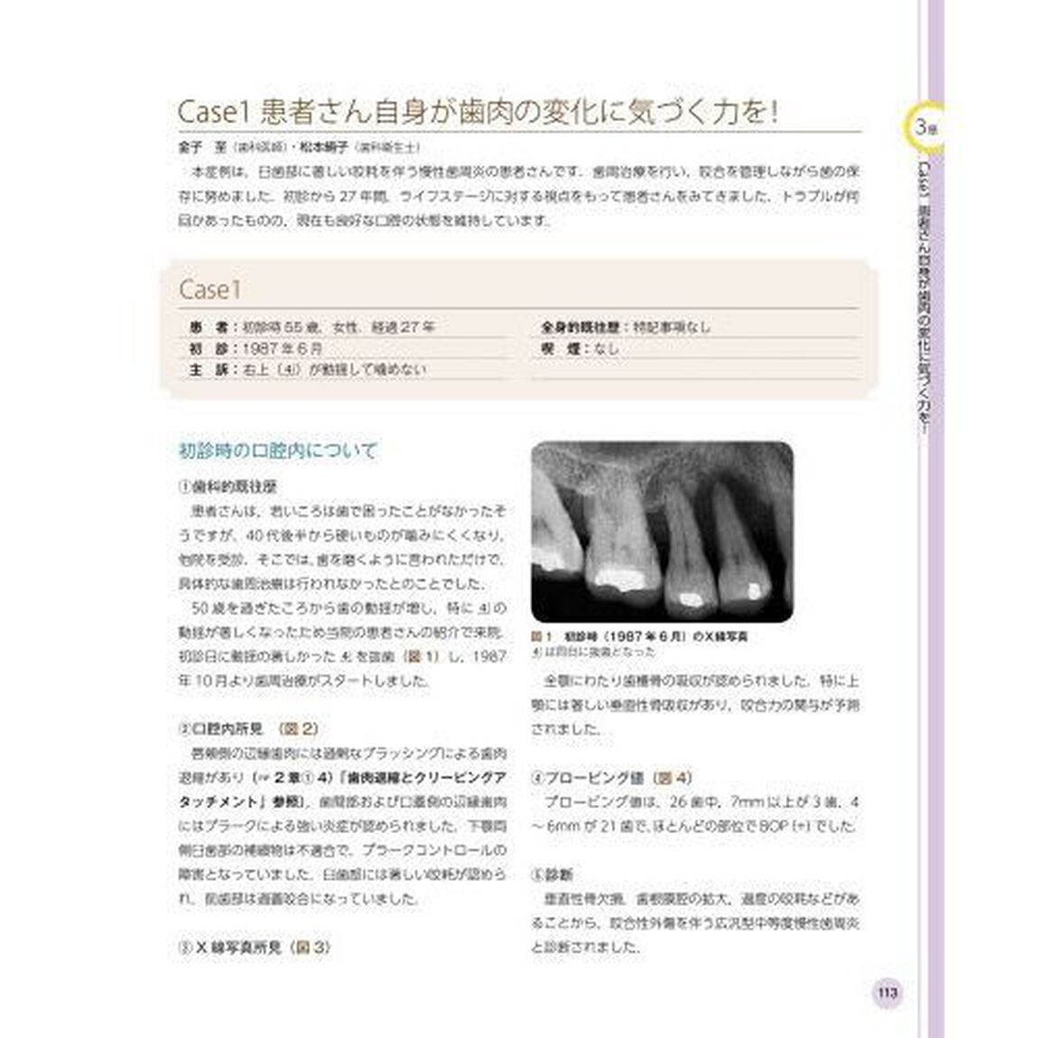 歯肉を読み解く　臨床&times;病理の眼から歯肉の&ldquo;なぜ&rdquo;にこたえます！