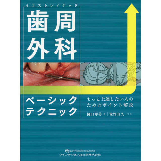 イラストレイテッド歯周外科ベーシックテクニック　もっと上達したい人のためのポイント解説