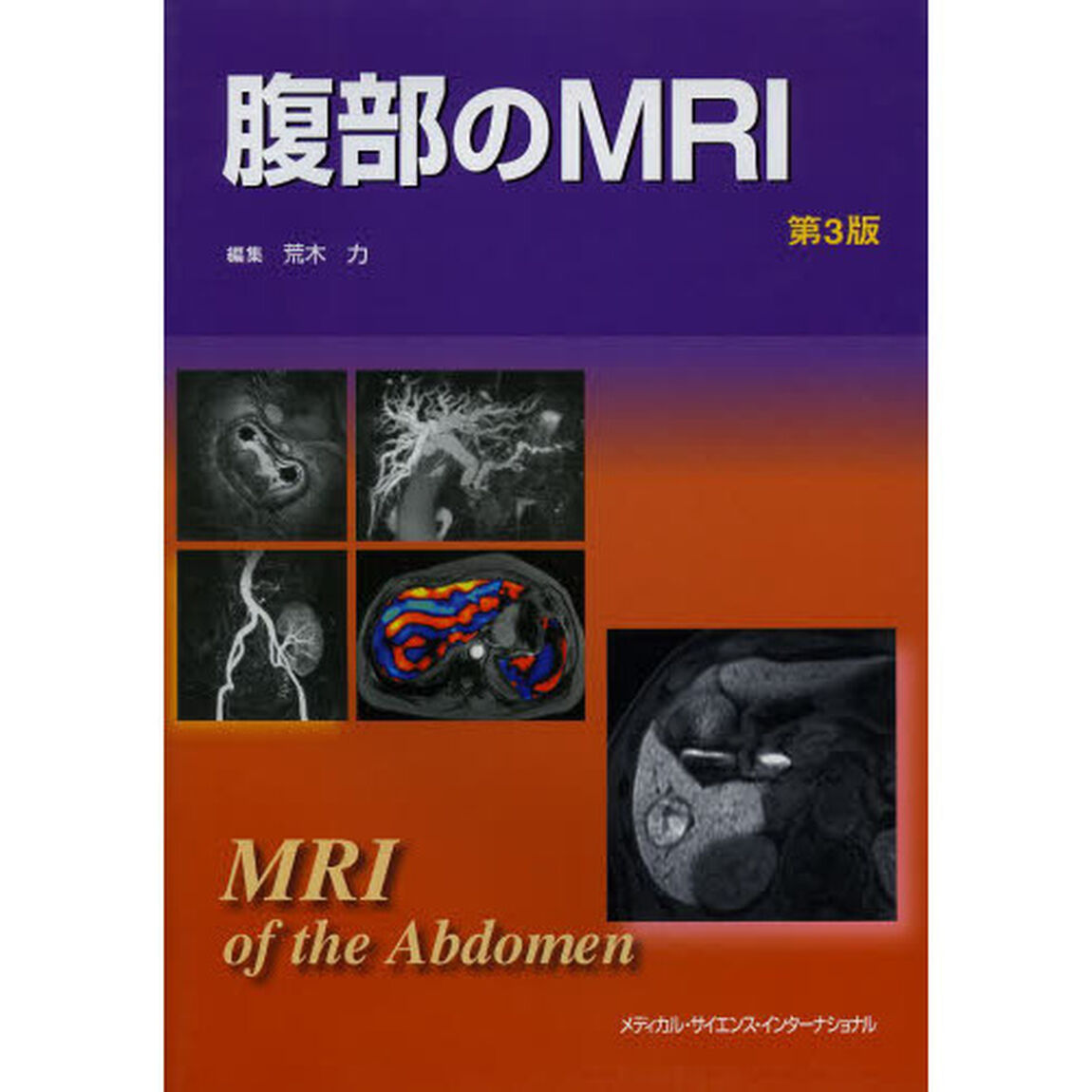 腹部のＭＲＩ「第３版」