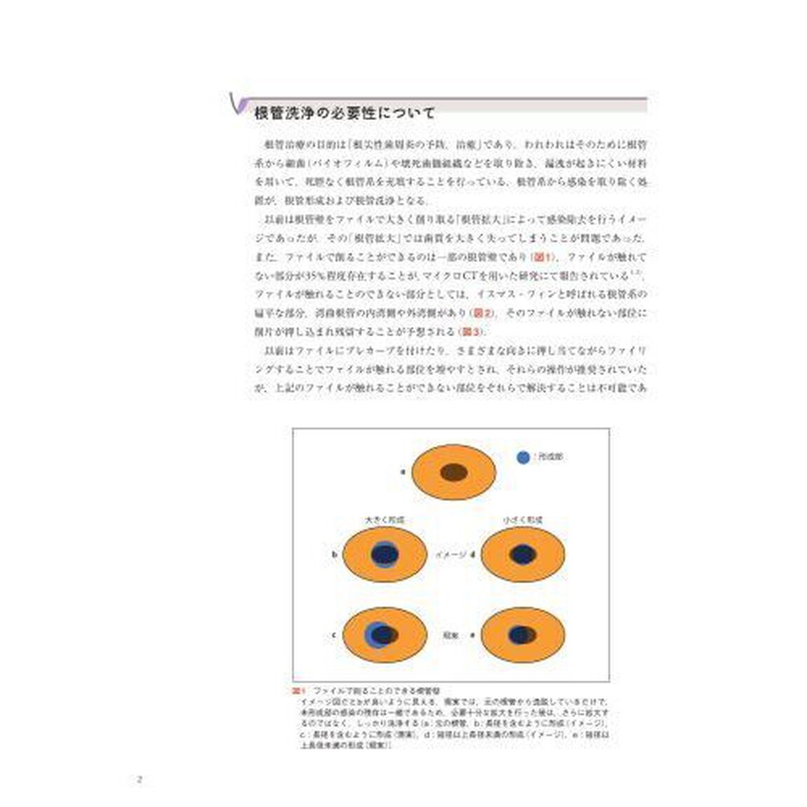 根管洗浄