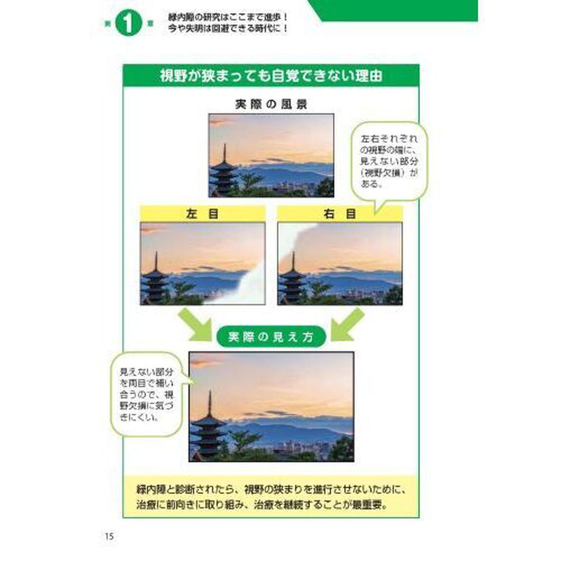 緑内障眼科医の私が患者ならこう対処！名医が教える最新１分習慣大全