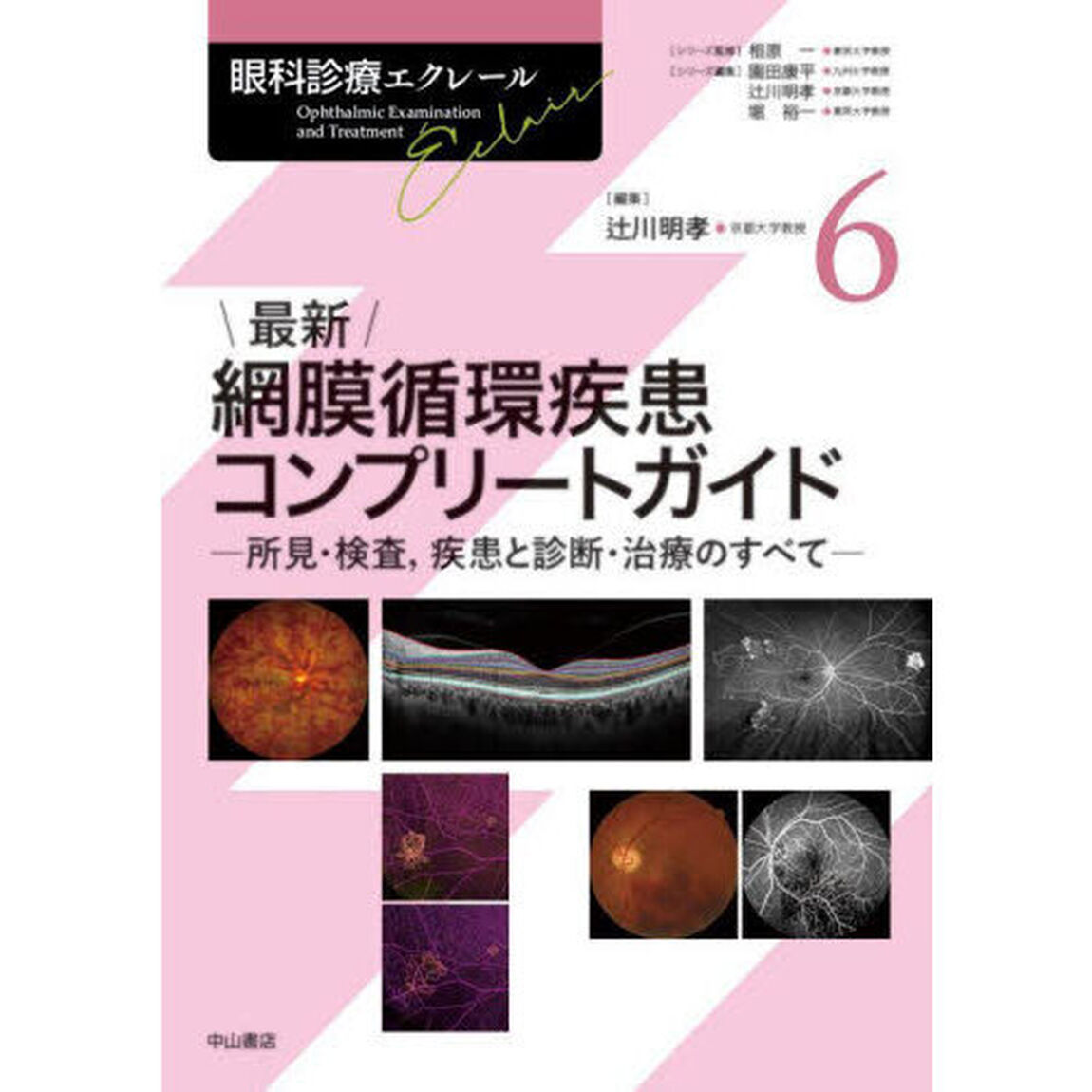 眼科診療エクレール　６「最新網膜循環疾患コンプリートガイド　所見・検査，疾患と診断・治療のすべて」
