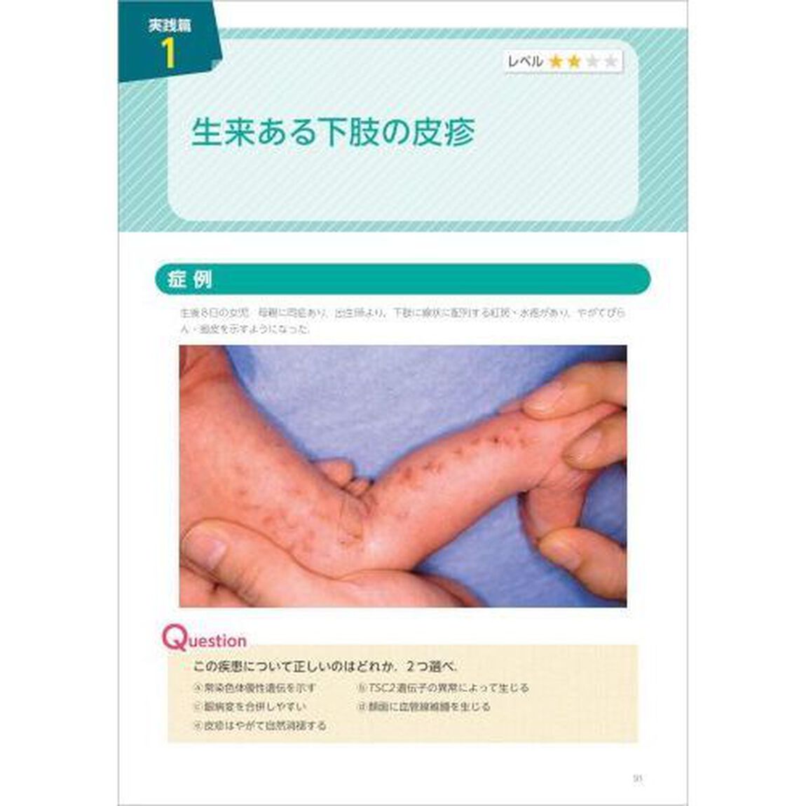 皮膚診療ドリル　あらゆる臨床医のための「皮疹の診かた」問題集