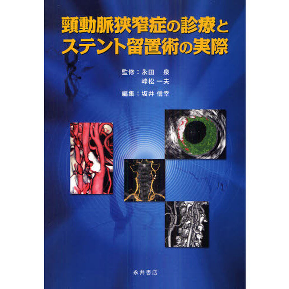 頸動脈狭窄症の診療とステント留置術の実際