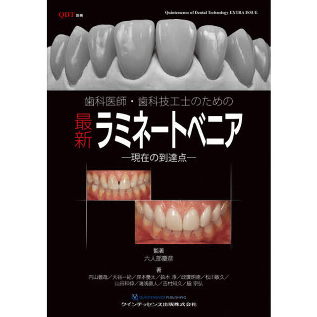 歯科医師・歯科技工士のための最新ラミネートベニア　現在の到達点