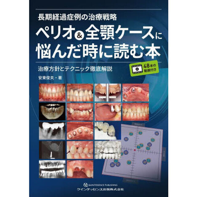 長期経過症例の治療戦略ペリオ＆全顎ケースに悩んだ時に読む本　治療方針とテクニック徹底解説