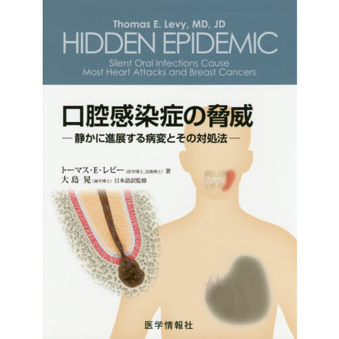 口腔感染症の脅威　静かに進展する病変とその対処法