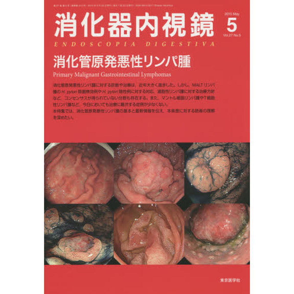 消化器内視鏡　Ｖｏｌ．２７Ｎｏ．５（２０１５Ｍａｙ）「消化管原発悪性リンパ腫」
