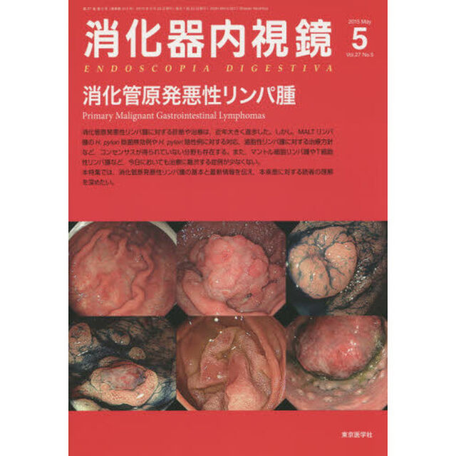 消化器内視鏡　Ｖｏｌ．２７Ｎｏ．５（２０１５Ｍａｙ）「消化管原発悪性リンパ腫」