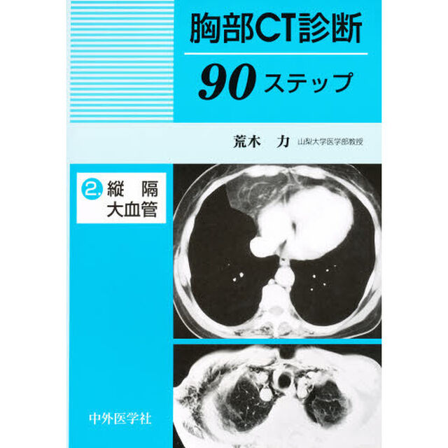 胸部ＣＴ診断９０ステップ　２「縦隔・大血管」
