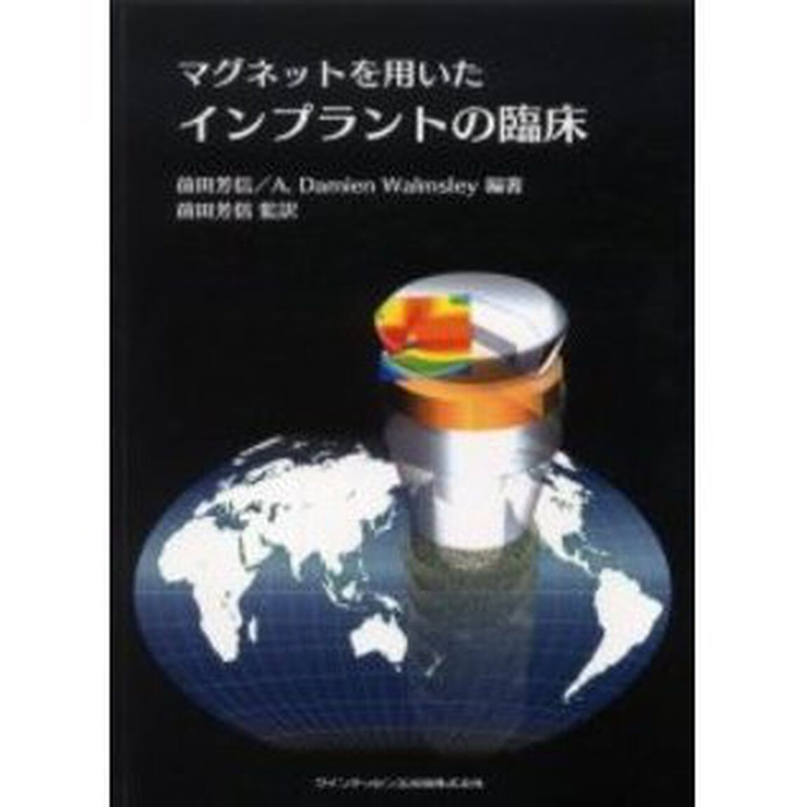 マグネットを用いたインプラントの臨床