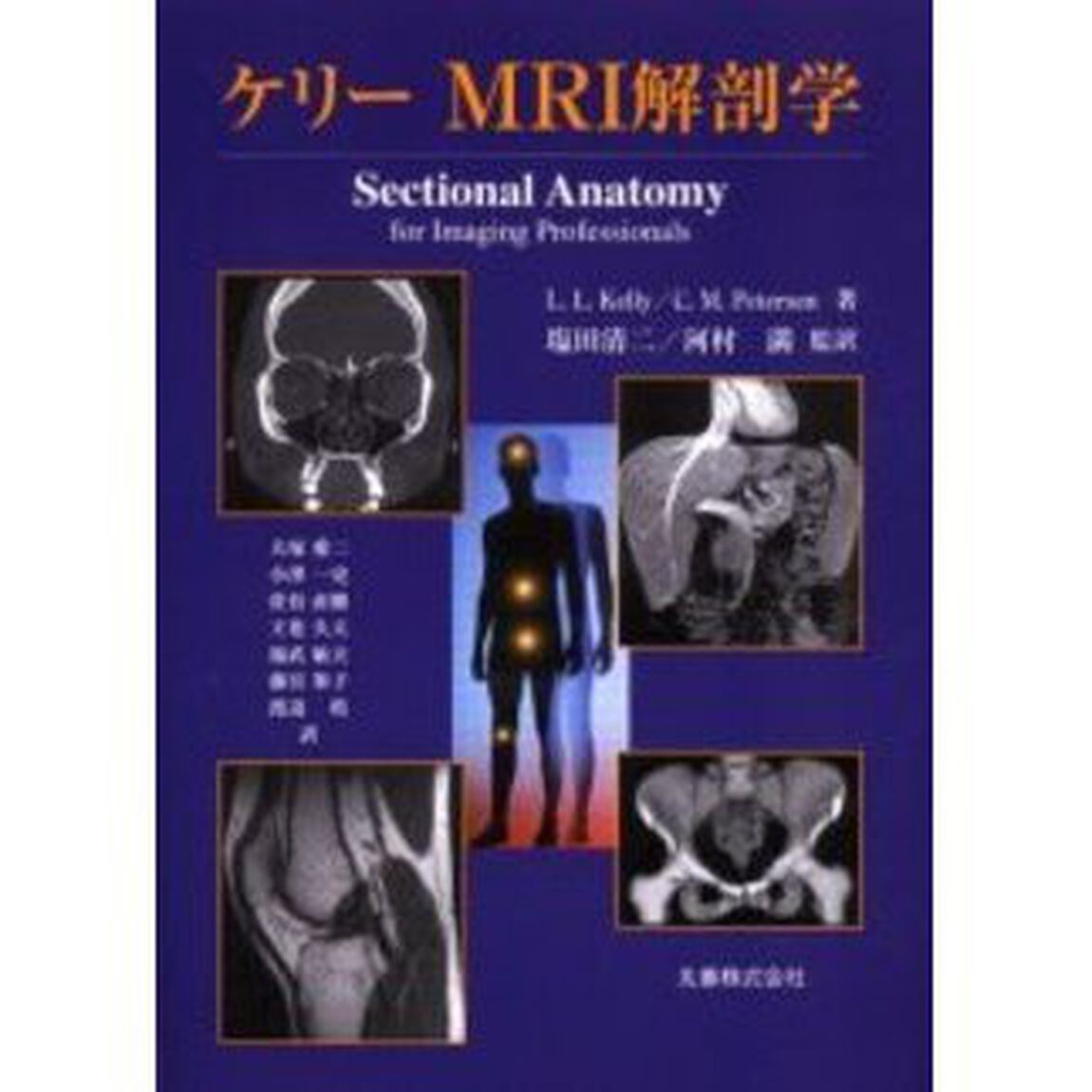 ケリーＭＲＩ解剖学