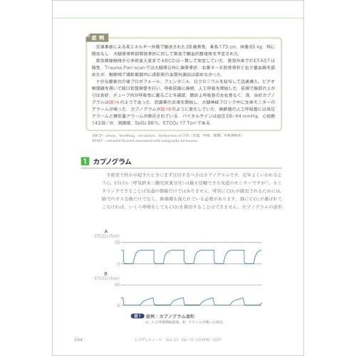 レジデントノート　プライマリケアと救急を中心とした総合誌　Ｖｏｌ．２３Ｎｏ．１０（２０２１－１０）「術中の全身管理を任された！」