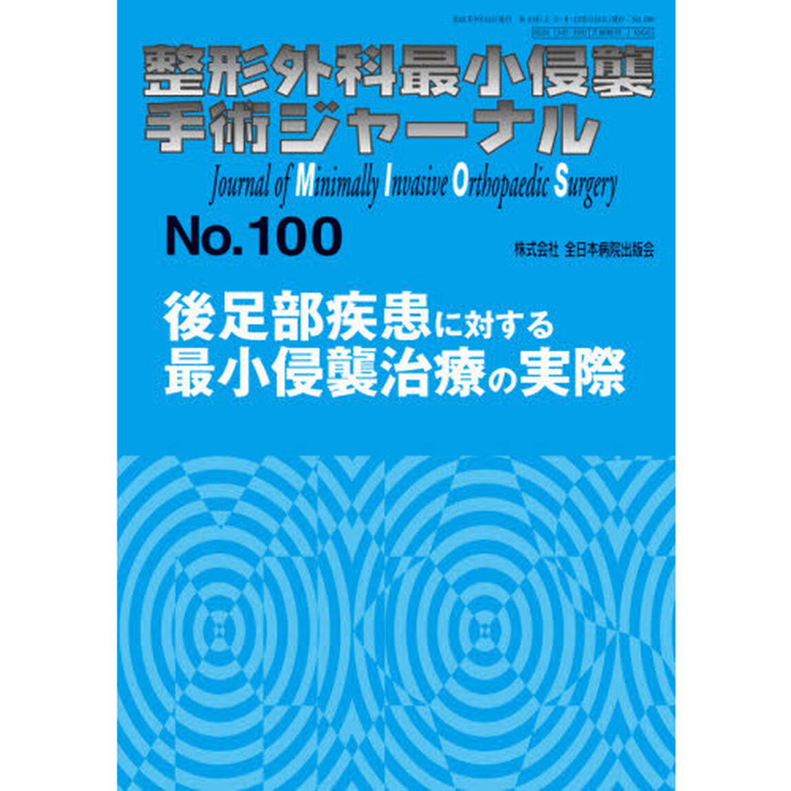 整形外科最小侵襲手術ジャーナル　Ｎｏ．１００「後足部疾患に対する最小侵襲治療の実際」