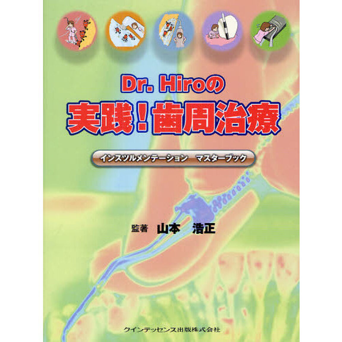 Ｄｒ．Ｈｉｒｏの実践！歯周治療　インスツルメンテーションマスターブック