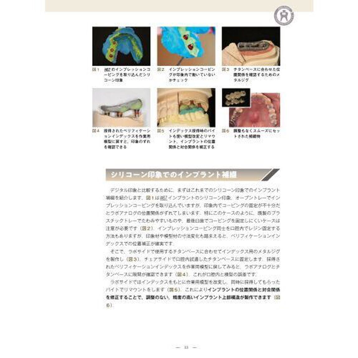 チェアサイドとラボサイドの連携が生む質の高い補綴のための核心２４