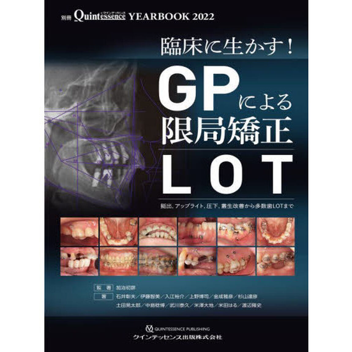 ＹＥＡＲ　ＢＯＯＫ　２０２２「臨床に生かす！ＧＰによる限局矯正〈ＬＯＴ〉　挺出，アップライト，圧下，叢生改善から多数歯ＬＯＴまで」