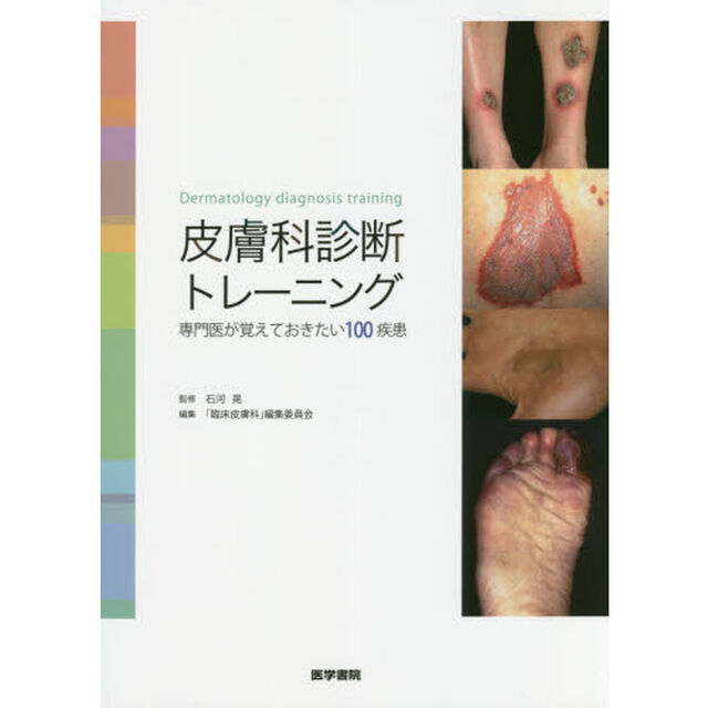 皮膚科診断トレーニング　専門医が覚えておきたい１００疾患