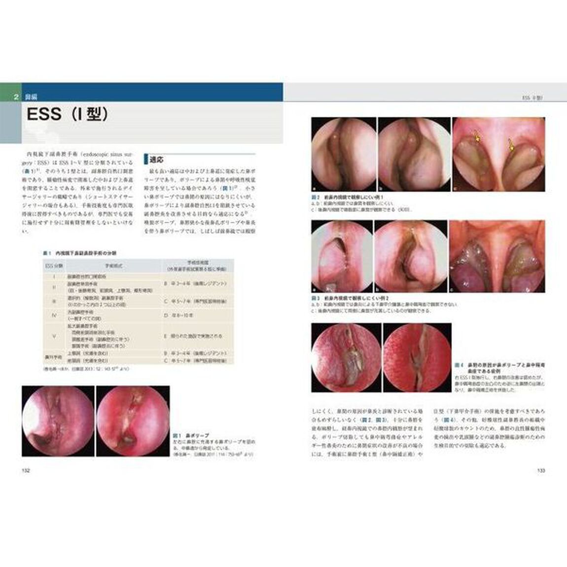 プラクティス耳鼻咽喉科の臨床　２「耳鼻咽喉科外来処置・外来手術最新マニュアル」