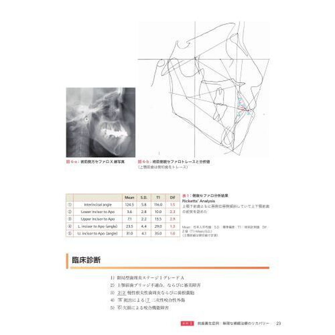 ＧＰが行う矯正治療を組み入れた咬合再構成　フローチャートでわかる治療計画立案