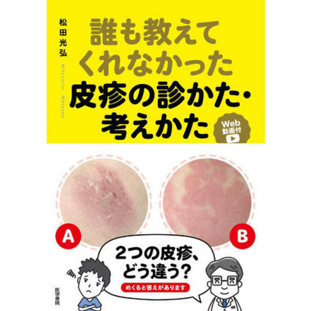 誰も教えてくれなかった皮疹の診かた・考えかた　Ｗｅｂ動画付