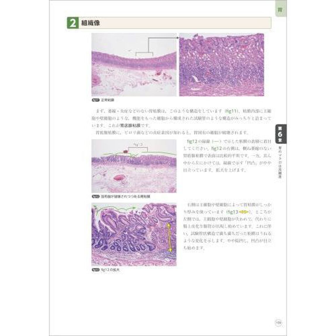 Ｄｒ．ヤンデルの臨床に役立つ消化管病理　臨床像・病理像の徹底対比で病変の本質を見抜く！