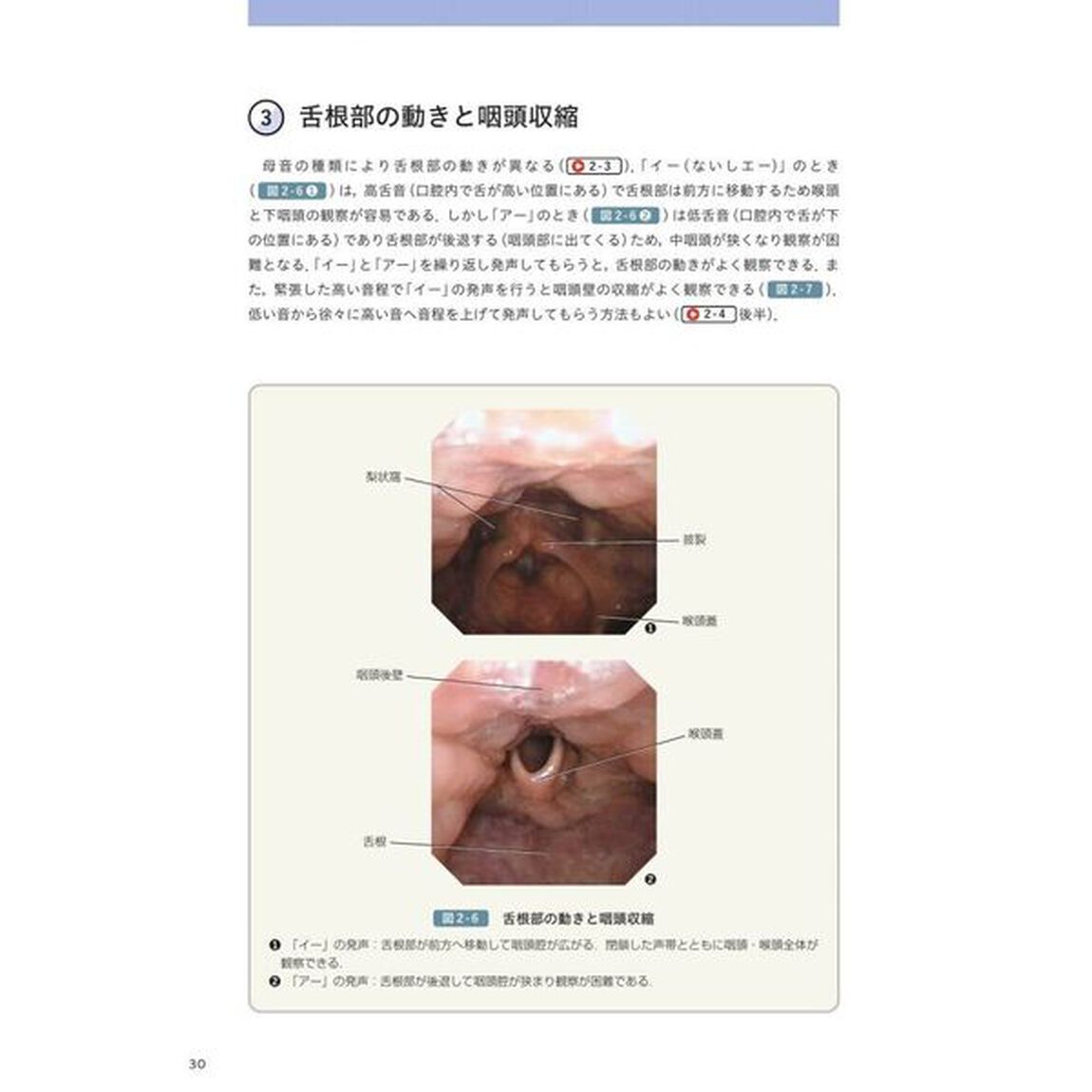 目でみる嚥下障害