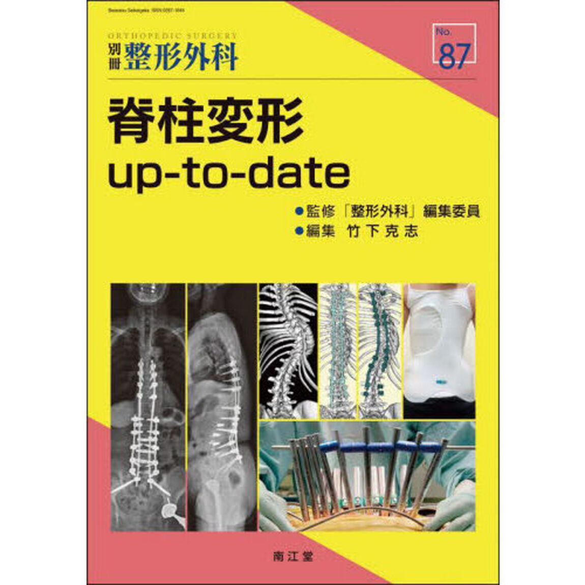 脊柱変形ｕｐ‐ｔｏ‐ｄａｔｅ