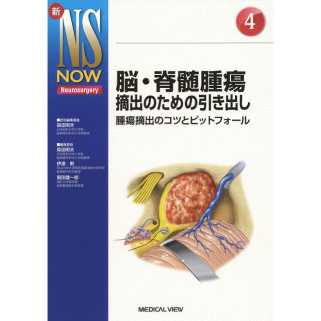 脳・脊髄腫瘍摘出のための引き出し　腫瘍摘出のコツとピットフォール