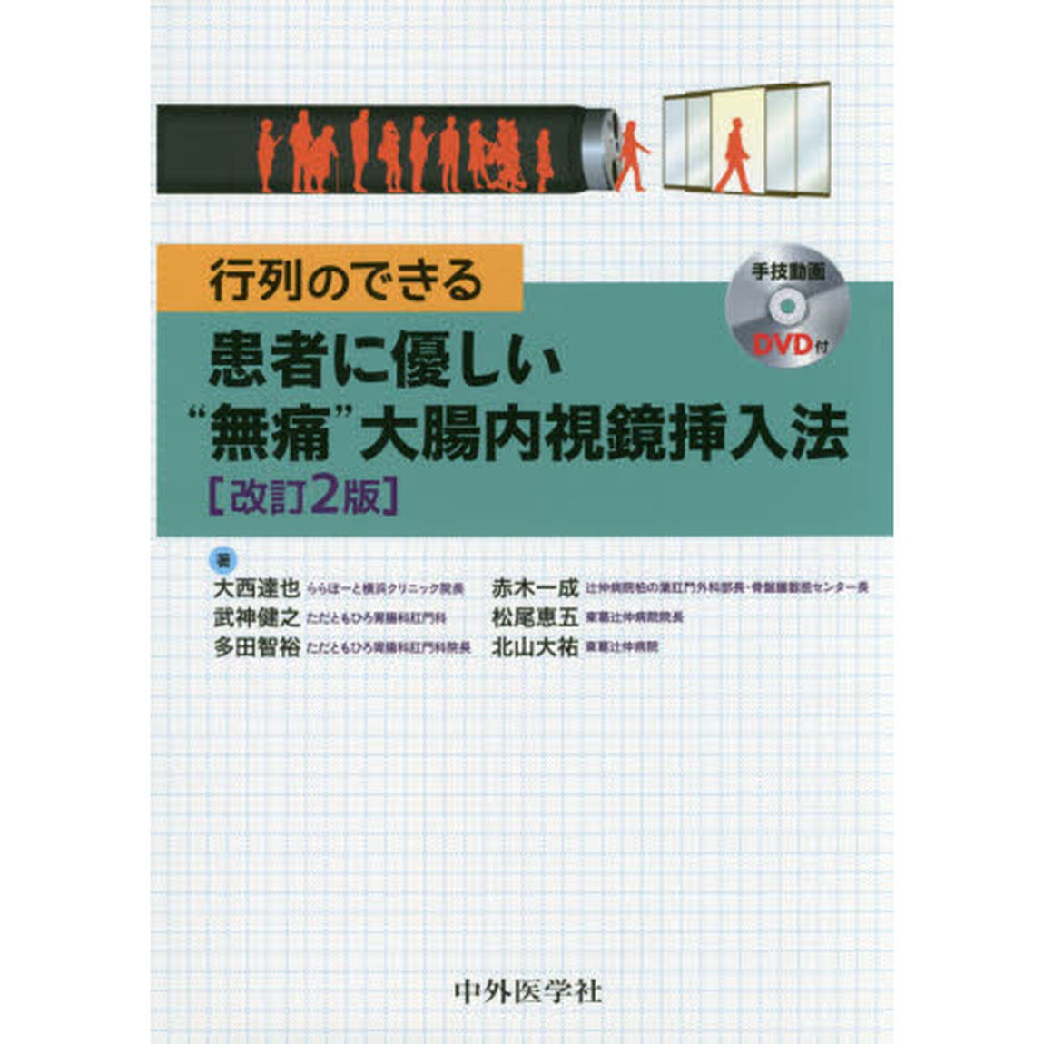 行列のできる患者に優しい&ldquo;無痛&rdquo;大腸内視鏡挿入法「改訂２版」