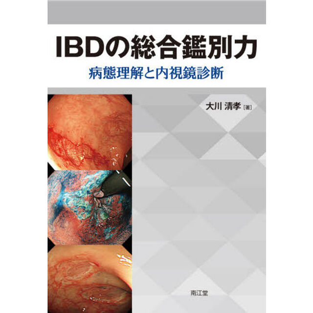 ＩＢＤの総合鑑別力　病態理解と内視鏡診断