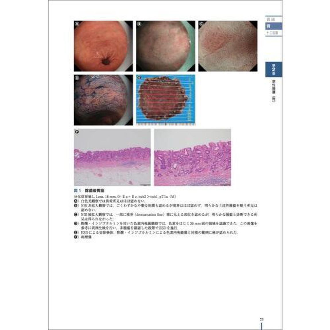 美しい画像で見る内視鏡アトラス上部消化管　腫瘍から感染性・炎症性疾患まで、典型例とピットフォール画像で鑑別点を理解する