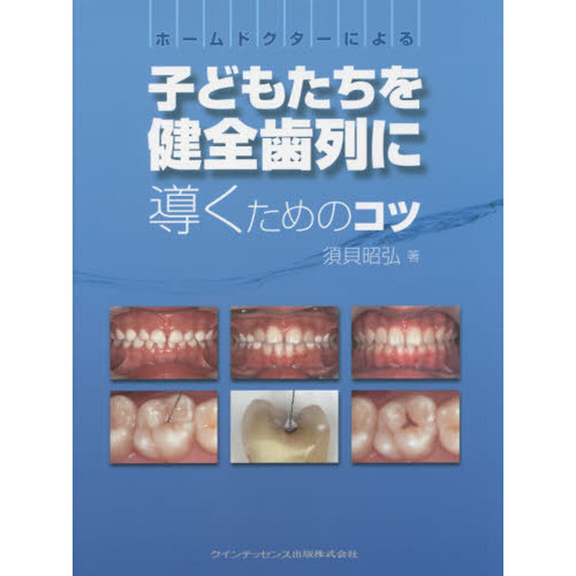 ホームドクターによる子どもたちを健全歯列に導くためのコツ