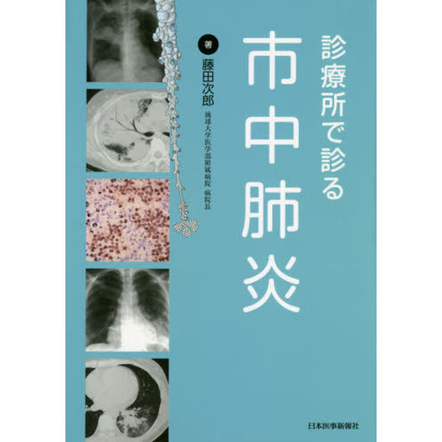 診療所で診る市中肺炎