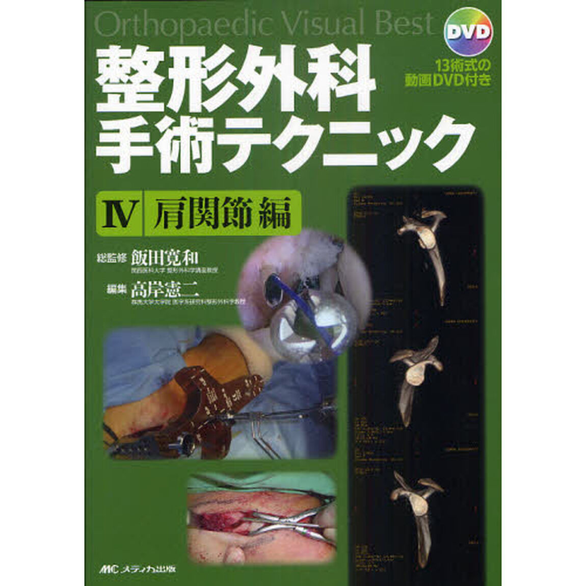 整形外科手術テクニック　Ｏｒｔｈｏｐａｅｄｉｃ　Ｖｉｓｕａｌ　Ｂｅｓｔ　４「肩関節編」