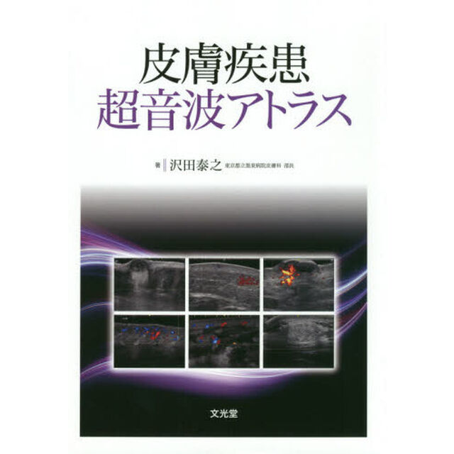 皮膚疾患超音波アトラス