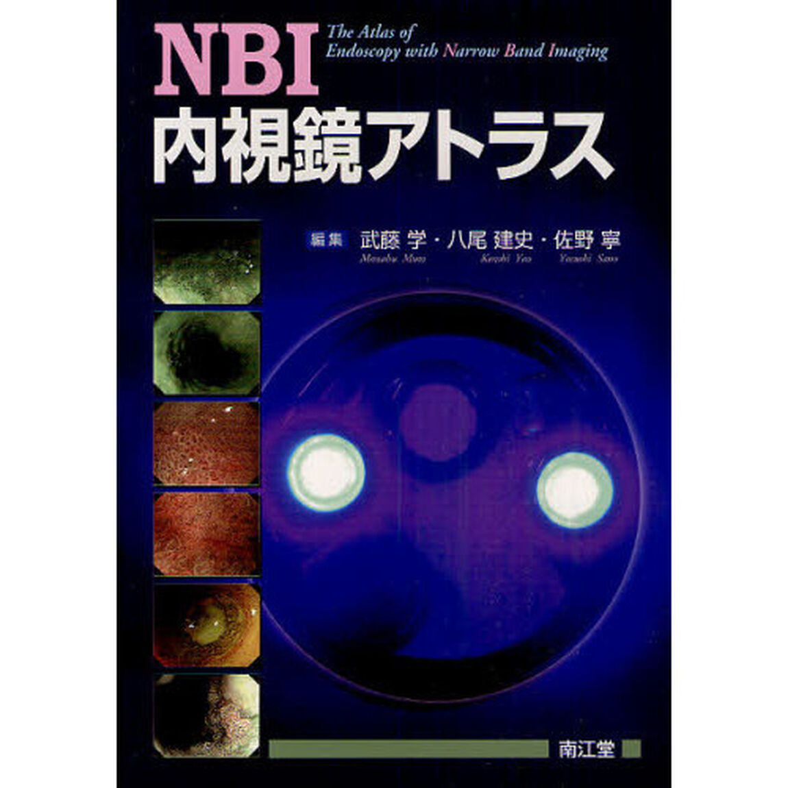 ＮＢＩ内視鏡アトラス