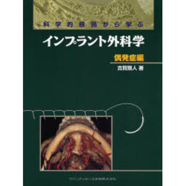 科学的根拠から学ぶインプラント外科学　偶発症編