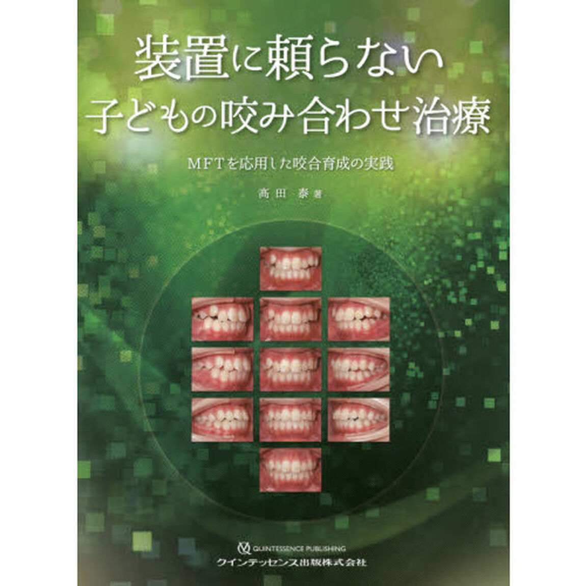 装置に頼らない子どもの咬み合わせ治療　ＭＦＴを応用した咬合育成の実践