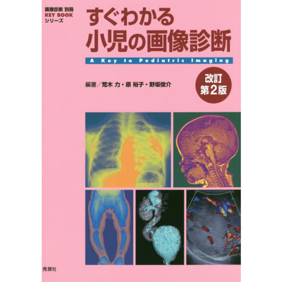 すぐわかる小児の画像診断「改訂第２版」