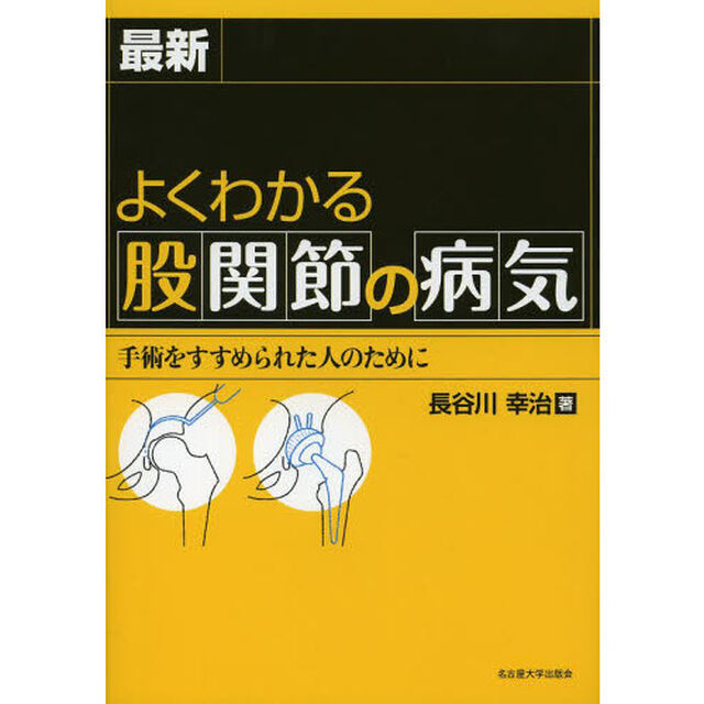 最新よくわかる股関節の病気　手術をすすめられた人のために