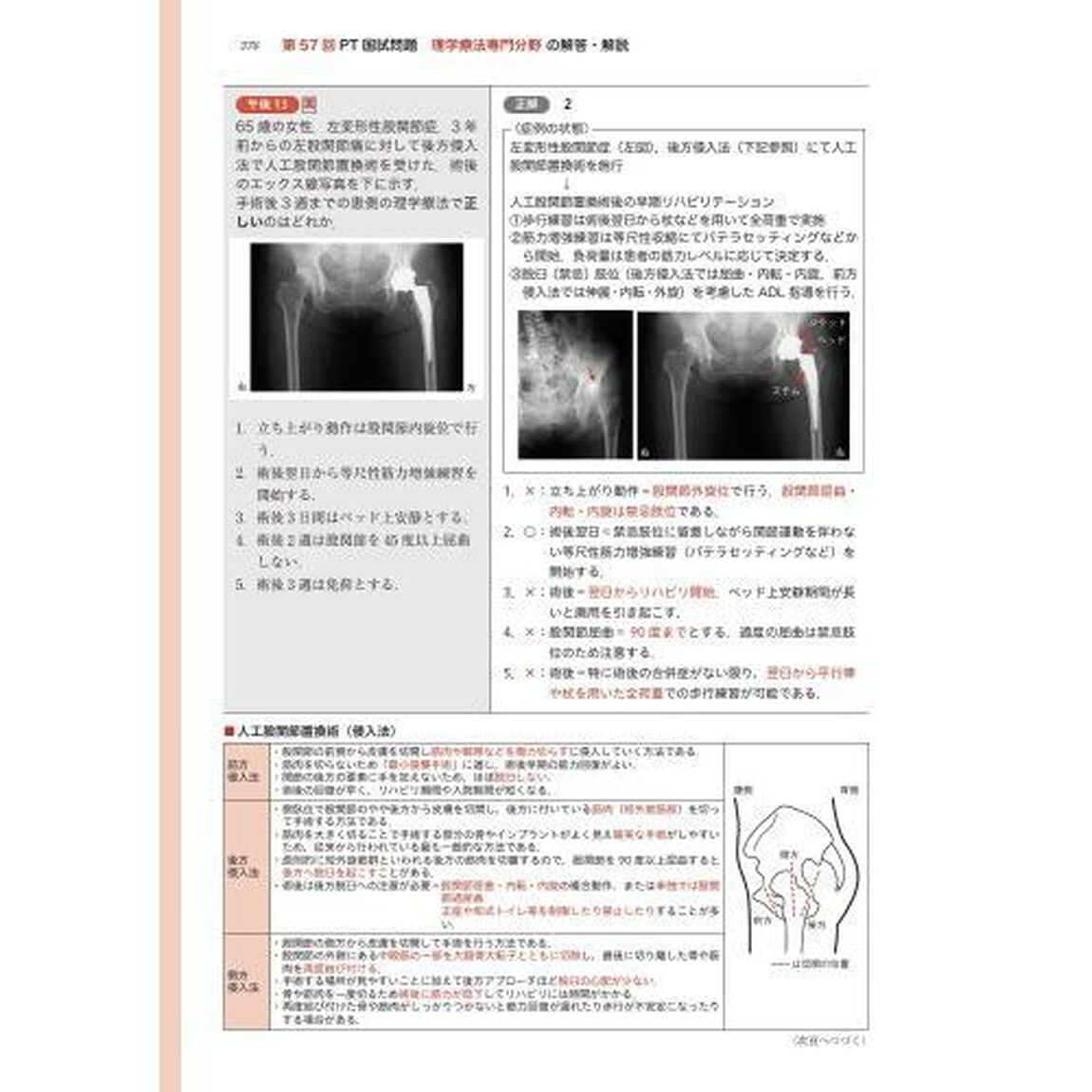 ＰＴ／ＯＴ国家試験必修ポイント障害別ＰＴ治療学　２０２３「障害領域別理学療法治療学　骨関節障害　中枢神経障害　末梢神経・筋障害　呼吸器・循環器・代謝障害　運動・発達障害　その他の障害」