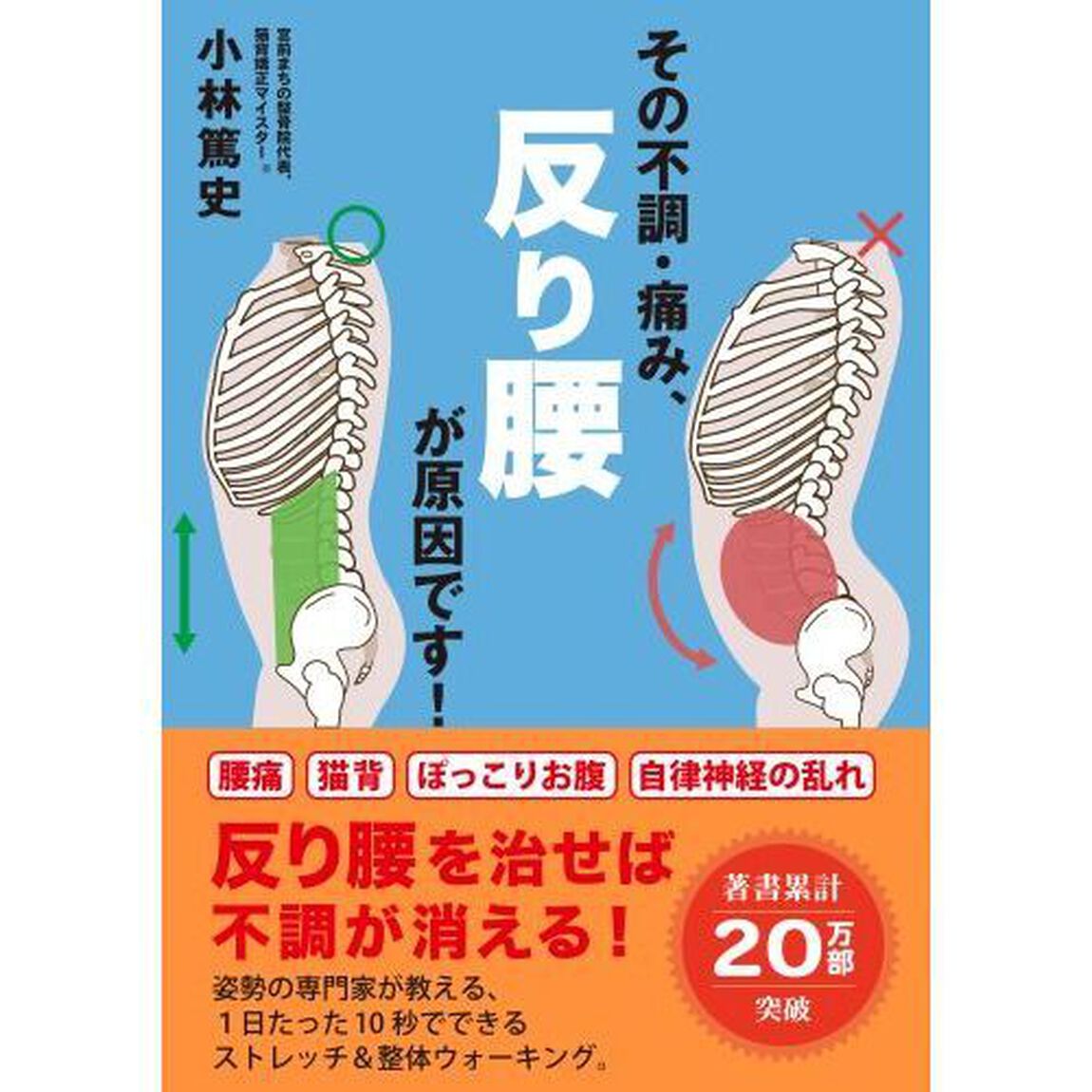 その不調・痛み、反り腰が原因です！