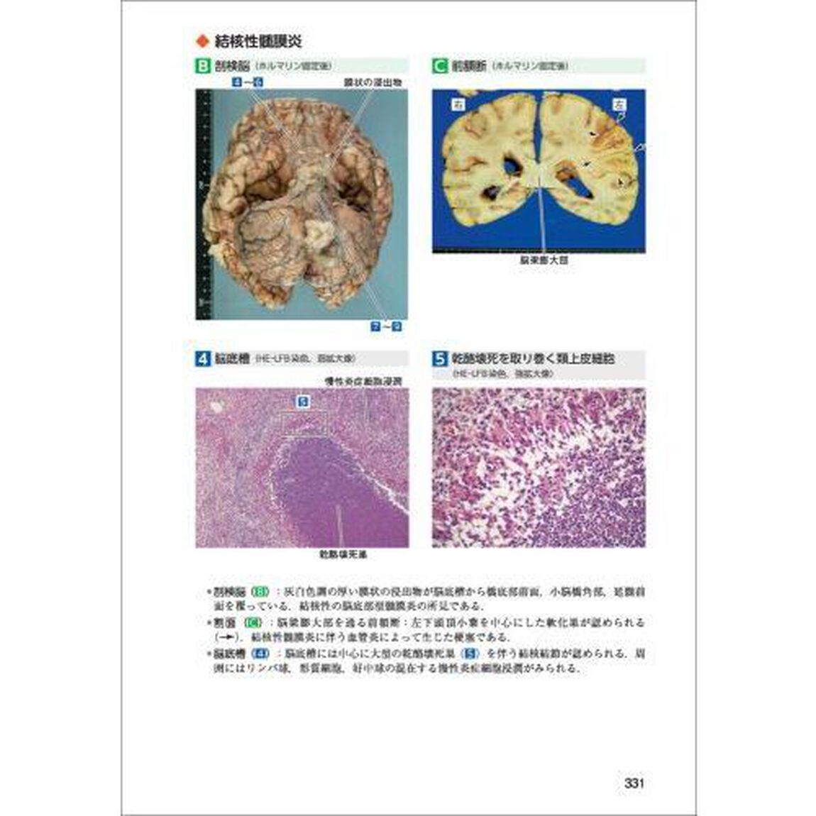 正常画像と比べてわかる病理アトラス　マクロとミクロの対応で捉える病態「第３版」