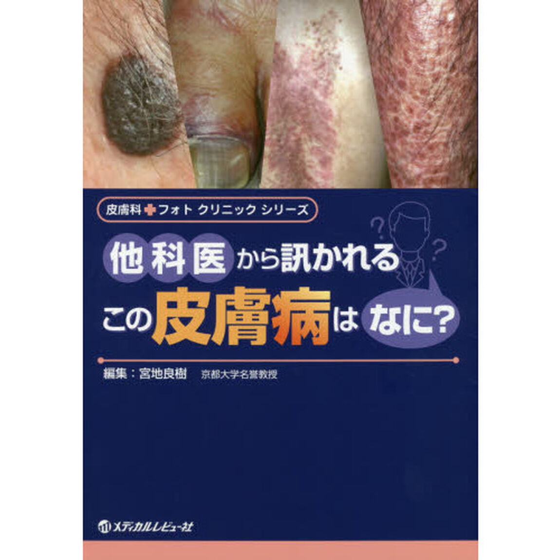 他科医から訊かれるこの皮膚病はなに？