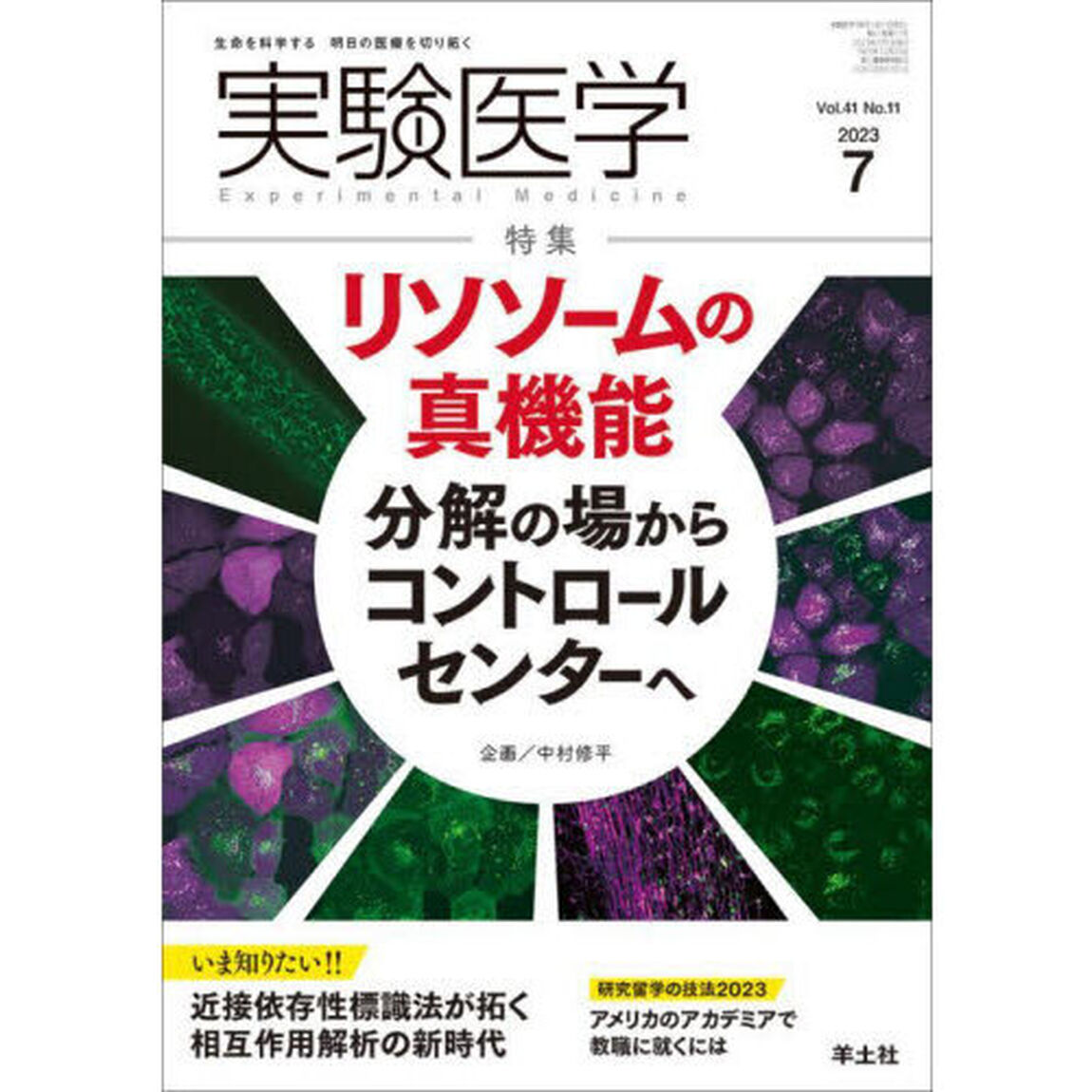 実験医学　Ｖｏｌ．４１Ｎｏ．１１（２０２３－７）「〈特集〉リソソームの真機能／近接依存性標識」