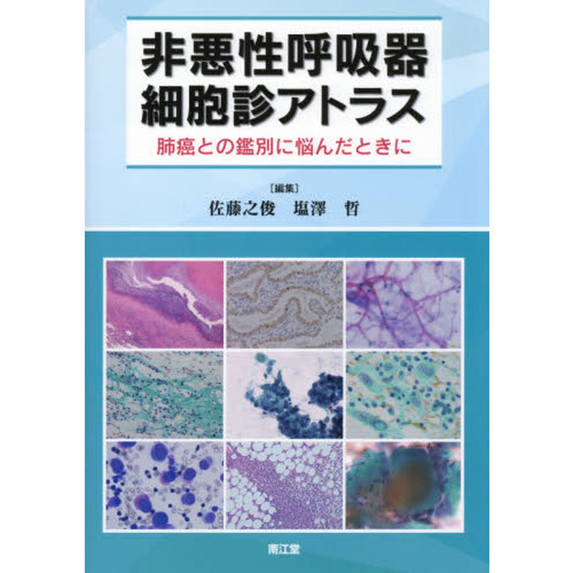 非悪性呼吸器細胞診アトラス　肺癌との鑑別に悩んだときに