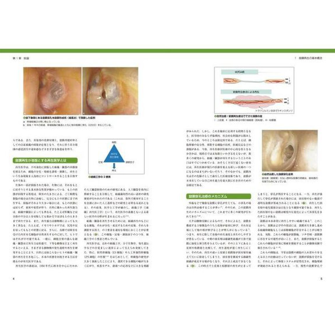 鼓膜再生療法手術手技マニュアル